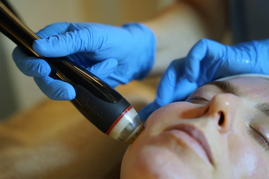 Close up of a facial treatment with the innovative Alma laser device at the Mirenmedic clinic.