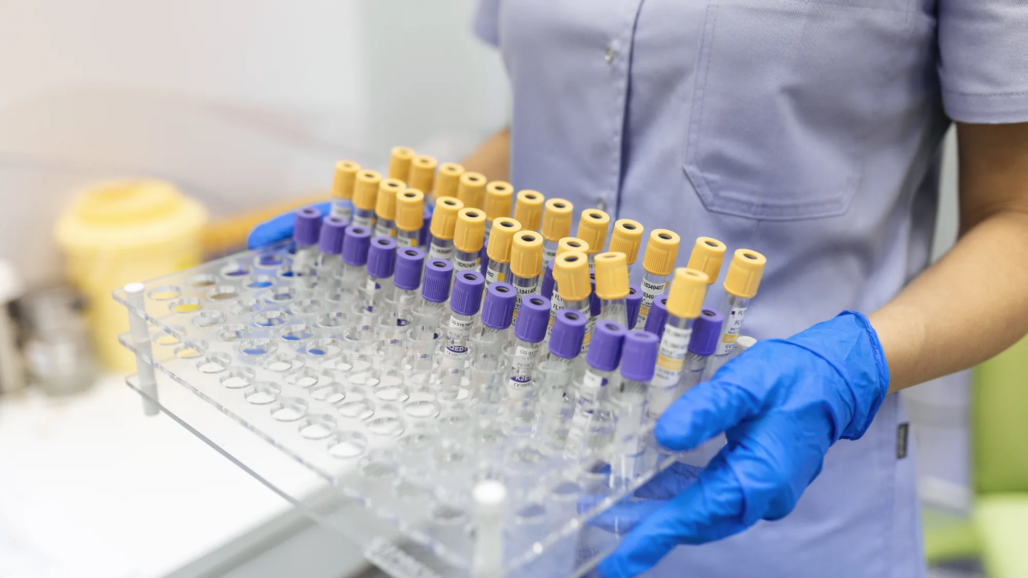 Laborant uzima epruvetu sa krvlju iz stalka u laboratoriji