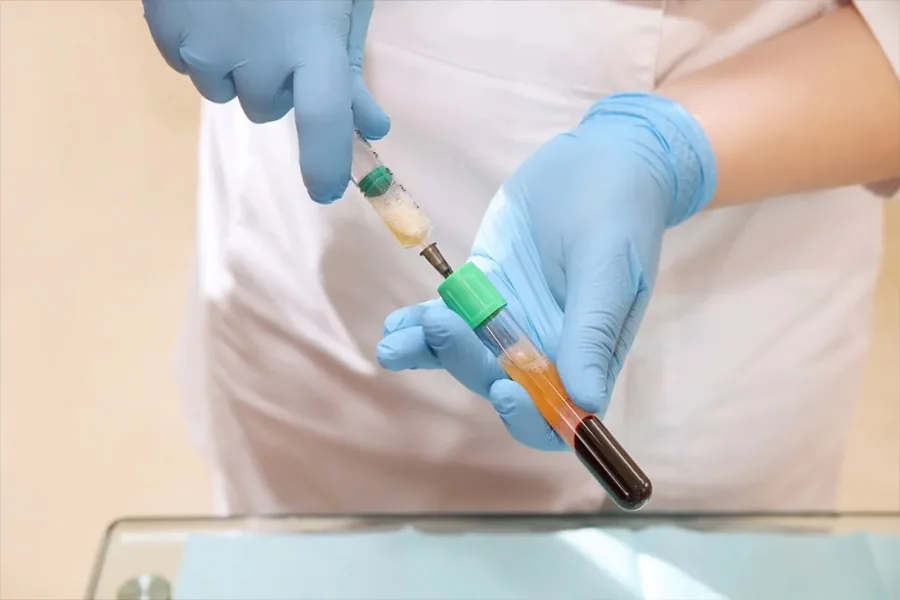 Practitioner at the Mirenmedic clinic preparing platelet rich plasma for a PRP treatment under sterile conditions.