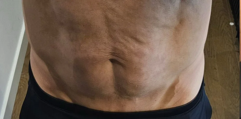 Morph1 1