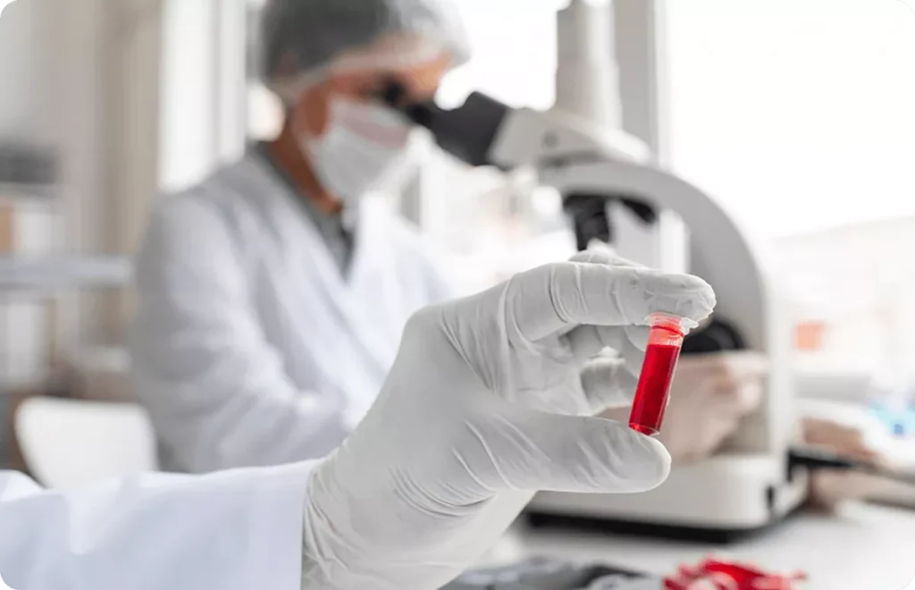 Laboratorijski tehničar sa rukavicama drži epruvetu sa uzorkom krvi ispred mikroskopa, privatna poliklinika Beograd